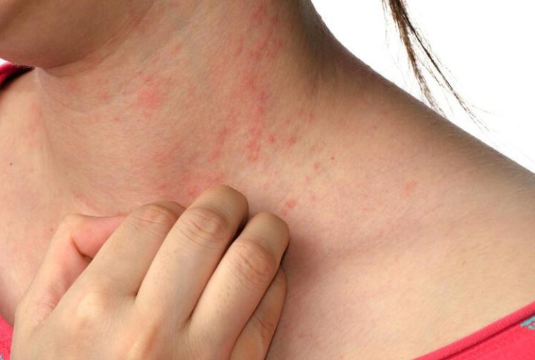 1739343785.304999_300349_image