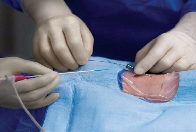 1739343793.885289_345021_image