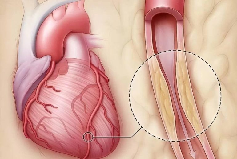 1739343803.295679_365356_image